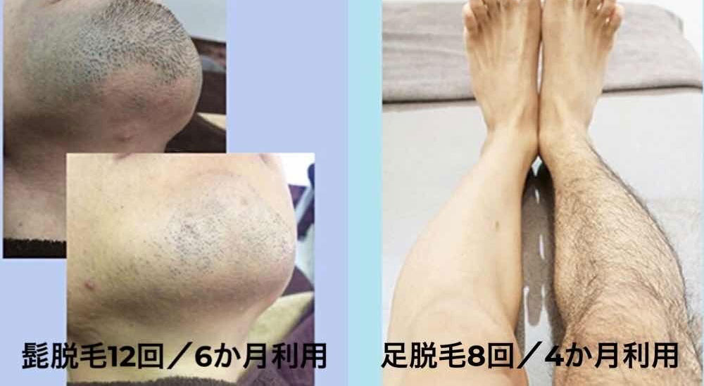 施術画像01